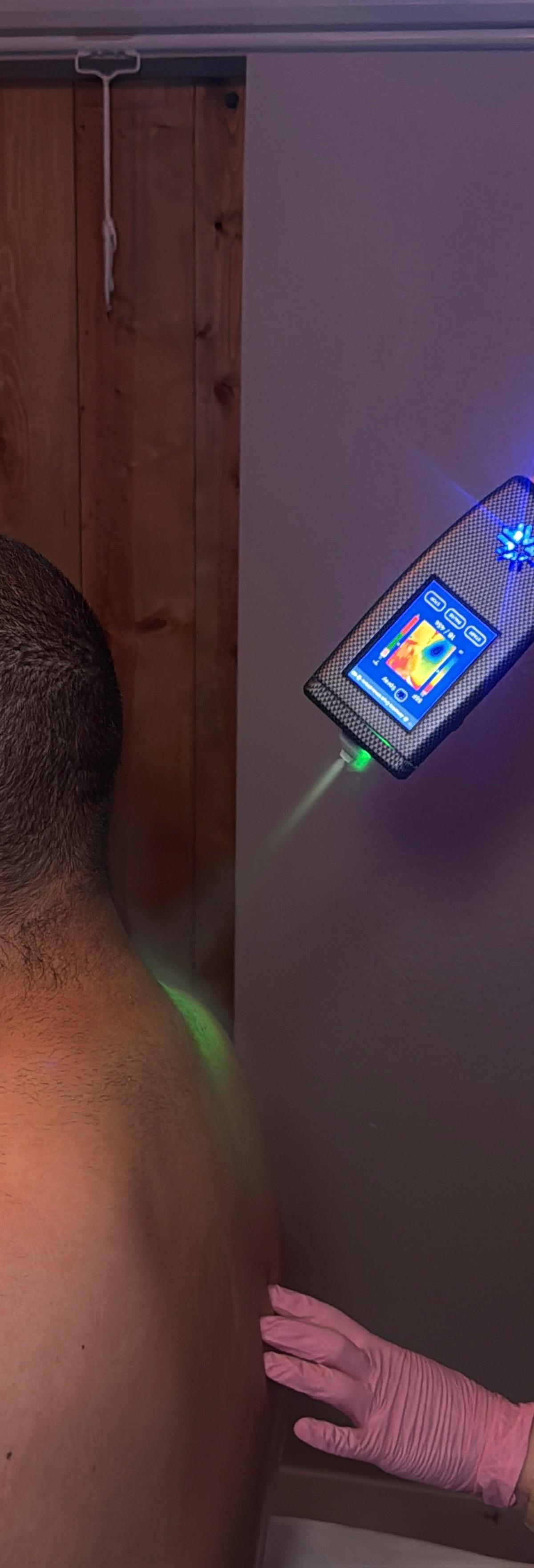 Cryo Innovations XR ISO — photo 4