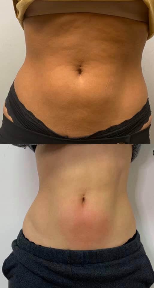 Cryo Lab Face + Body - Raleigh — recovery studio in Raleigh, NC